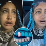 Dentistas alertam as crianças contra a tendência viral do TikTok, resultando em “danos que carregarão por décadas”