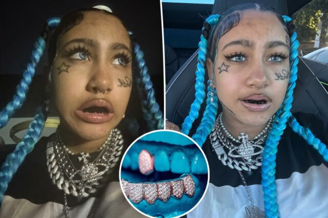 Dentistas alertam as crianças contra a tendência viral do TikTok, Dentistas alertam as crianças contra a tendência viral do TikTok, resultando em “danos que carregarão por décadas”