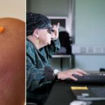 Dezenas de pessoas cegas podem ver graças ao novo microchip revolucionário: ‘Nunca foi feito antes’