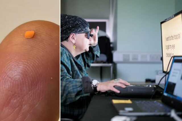 Dezenas de pessoas cegas podem ver graças ao novo microchip revolucionário: ‘Nunca foi feito antes’

