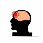 Lesão cerebral
