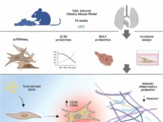 O peso excessivo extremo desencadeia pulmões para envelhecer muito cedo, o estudo de pesquisa recomenda A obesidade faz com que os pulmões envelhecem prematuramente