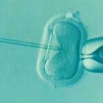 Óvulos de doadores impulsionam a maioria dos sucessos de fertilização in vitro para mulheres com mais de 43 anos, segundo novo estudo importante do Reino Unido