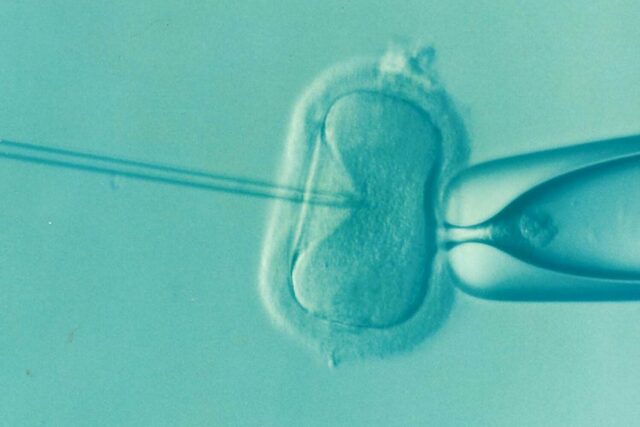 Os óvulos contribuintes impulsionam a maioria dos sucessos de fertilização Óvulos de doadores impulsionam a maioria dos sucessos de fertilização in vitro para mulheres com mais de 43 anos, segundo novo estudo importante do Reino Unido