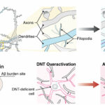 Os cientistas identificam uma nova rede nanotubular dendrítica no cérebro que pode contribuir para a doença de Alzheimer