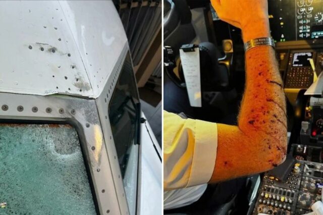 Braço do piloto coberto de cortes e sangue, próximo ao painel de controle da cabine.