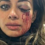 Hannah Thomas ficou gravemente ferida após um protesto anti-Israel no oeste de Sydney.
