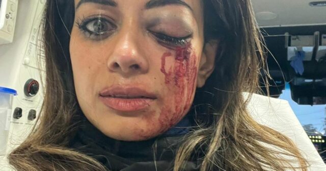 Hannah Thomas ficou gravemente ferida após um protesto anti-Israel no oeste de Sydney. 