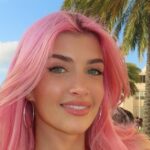 Sami Sheen oferece mais informações sobre cirurgia plástica após vídeo viral