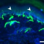 Uma molécula promissora contra neuropatias induzidas por quimioterapia