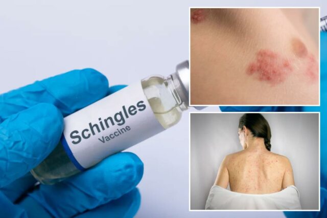 Vacina contra herpes zoster está associada a benefícios significativos à Vacina contra herpes zoster está associada a benefícios significativos à saúde, revelam especialistas