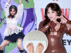A estrela do K-pop HyunA desmaia no meio do desempenho, gerando preocupação com a recente perda de peso A estrela do K-pop HyunA desmaia no meio do desempenho, gerando preocupação com a recente perda de peso