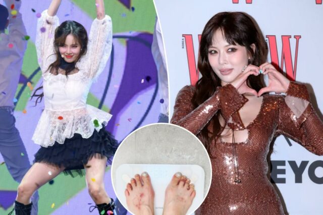 A estrela do K-pop HyunA desmaia no meio do desempenho, gerando preocupação com a recente perda de peso
