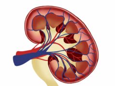 A intervenção de melhoria da qualidade pode ajudar a prevenir mortes por ácido láctico associado à metformina rim