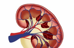 A intervenção de melhoria da qualidade pode ajudar a prevenir mortes por ácido láctico associado à metformina rim