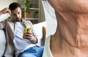 A maneira sorrateira com que seu telefone está envelhecendo – está “se tornando mais prevalente” em pacientes mais jovens A maneira sorrateira com que seu telefone está envelhecendo – está “se tornando mais prevalente” em pacientes mais jovens