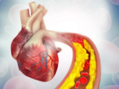 Austrália lidera primeiro teste de terapia de edição genética para reduzir pela metade o colesterol ruim Austrália lidera primeiro teste de terapia de edição genética para reduzir pela metade o colesterol ruim