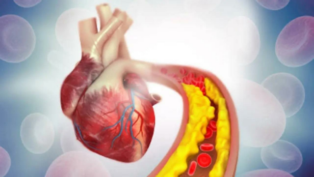 Austrália lidera primeiro teste de terapia de edição genética para reduzir pela metade o colesterol ruim
