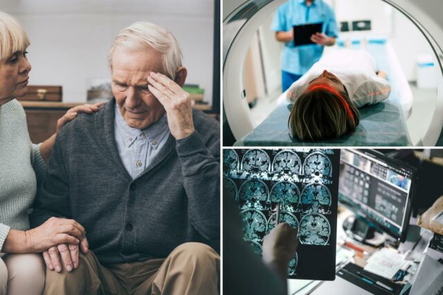 Cientistas do Alzheimer descobrem a chave para deter o declínio Cientistas do Alzheimer descobrem a chave para deter o declínio cerebral antes dos sintomas