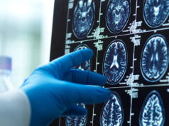 Cientistas ficaram surpresos após descobrirem ‘bolhas vítreas’ dentro do cérebro humano: ‘Esta é a primeira vez’ Yahoo news home