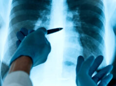 Cientistas preocupados após descoberta ‘surpreendente’ nas profundezas dos pulmões de todas as pessoas vivas: ‘Não esperávamos encontrar (isto)’ Yahoo news home