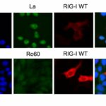 Como uma pequena molécula de RNA no rim desencadeia uma doença autoimune mortal