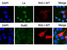 Como uma pequena molécula de RNA no rim desencadeia uma doença autoimune mortal Como uma pequena molécula de RNA no rim desencadeia uma doença autoimune mortal