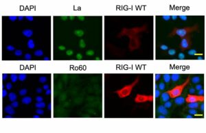 Como uma pequena molécula de RNA no rim desencadeia uma doença autoimune mortal Como uma pequena molécula de RNA no rim desencadeia uma doença autoimune mortal