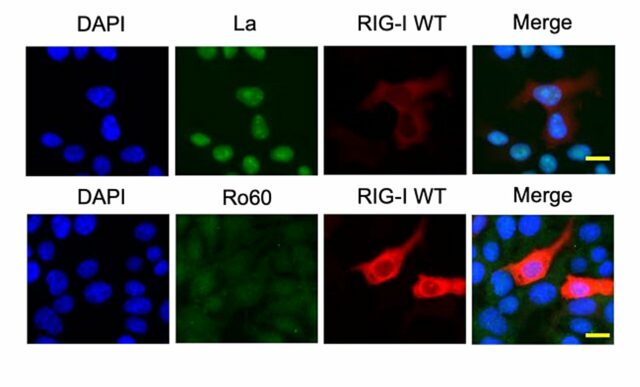 Como uma pequena molécula de RNA no rim desencadeia uma doença autoimune mortal