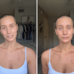 Encontrei um caroço na clavícula – o diagnóstico virou minha vida de cabeça para baixo