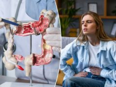 Esses alimentos podem estar impulsionando o aumento do câncer colorretal de início precoce em mulheres Esses alimentos podem estar impulsionando o aumento do câncer colorretal de início precoce em mulheres