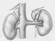 Estudo global constata mortalidade estável por lesão renal aguda com mudança nos padrões de idade rim
