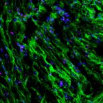 Estudo da Scripps Research revela como as contrações uterinas são reguladas pelo estiramento e pressão durante o parto