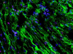 Estudo revela como as contrações uterinas são reguladas pelo estiramento e pressão durante o parto Estudo da Scripps Research revela como as contrações uterinas são reguladas pelo estiramento e pressão durante o parto