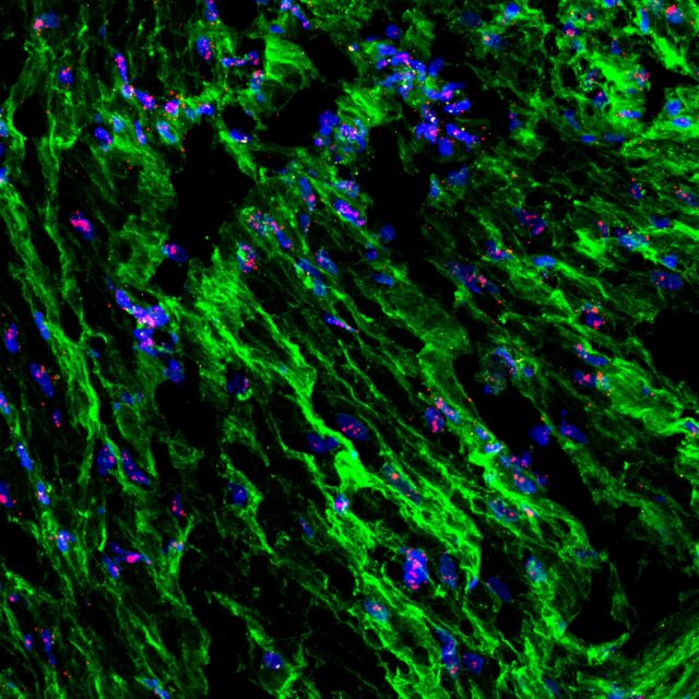 Estudo revela como as contrações uterinas são reguladas pelo estiramento Estudo da Scripps Research revela como as contrações uterinas são reguladas pelo estiramento e pressão durante o parto