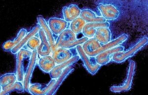 Etiópia confirma 3 mortes por vírus de Marburg em novo surto Vírus de Marburgo