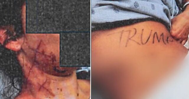 Ex-funcionária política acusada de encenar ataque anti-Trump contra si mesma Ex-funcionária política acusada de encenar ataque anti-Trump contra si mesma