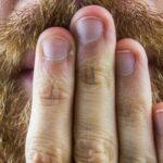 Fatos surpreendentes sobre os órgãos íntimos dos homens que você talvez não conheça, o número 2 irá surpreendê-lo!