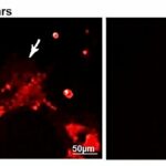 Um gene humano específico pode ajudar o coração a se recuperar de ataque cardíaco ou insuficiência cardíaca
