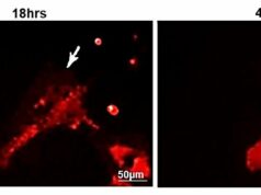 Gene humano específico pode ajudar o coração a se recuperar de ataque cardíaco ou insuficiência cardíaca Um gene humano específico pode ajudar o coração a se recuperar de ataque cardíaco ou insuficiência cardíaca