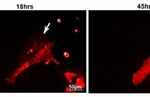 Gene humano específico pode ajudar o coração a se recuperar de ataque cardíaco ou insuficiência cardíaca Um gene humano específico pode ajudar o coração a se recuperar de ataque cardíaco ou insuficiência cardíaca