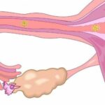 História viral de médico de emergência tratando de mulher em Garut cujo útero caiu