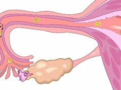 História viral de médico de emergência tratando de mulher em Garut cujo útero caiu História viral de médico de emergência tratando de mulher em Garut cujo útero caiu