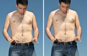 Homens que fizeram vasectomia estão compartilhando suas histórias e algumas delas podem surpreendê-lo Um paciente de camisa xadrez conversa com um profissional de saúde de uniforme médico, sentado em um consultório médico