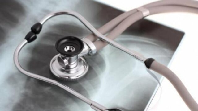 Horrorizado! Ministério da Saúde afirma que nenhuma província da Indonésia Horrorizado! Ministério da Saúde afirma que nenhuma província da Indonésia está livre da tuberculose