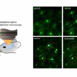 A nova tecnologia de imagem cerebral de alta resolução permite a observação em tempo real do cérebro do rato