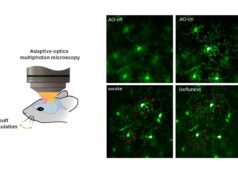 Imagens de alta velocidade rastreiam atividade de células cerebrais vivas em camundongos acordados A nova tecnologia de imagem cerebral de alta resolução permite a observação em tempo real do cérebro do rato