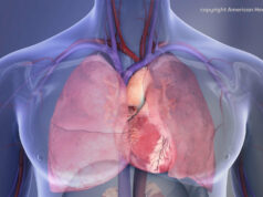 Melhorar o tratamento de coágulos sanguíneos potencialmente fatais Melhorar o tratamento de coágulos sanguíneos potencialmente fatais