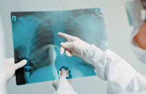 OMS elogia o progresso da Índia na redução das lacunas na detecção da TB e na taxa de mortalidade OMS elogia o progresso da Índia na redução das lacunas na detecção da TB e na taxa de mortalidade