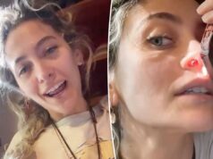 Paris Jackson mostra septo perfurado causado por anos de uso de drogas: ‘É daí que você pensa que vem’ Paris Jackson mostra septo perfurado causado por anos de uso de drogas: 'É daí que você pensa que vem'